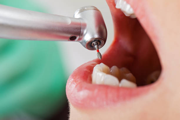 Best Cracked Tooth Emergency Dentist  in Roseland, NJ